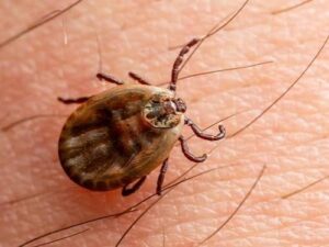 Summer Tick Safety
