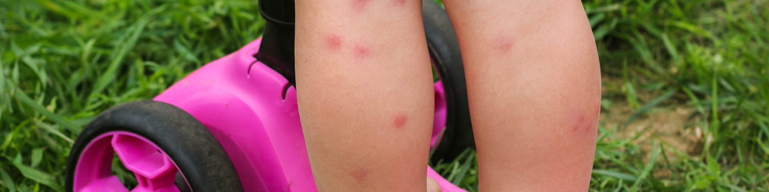 Mosquito Control